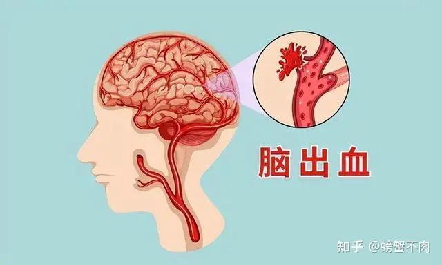 高血压的危害你注意了吗？